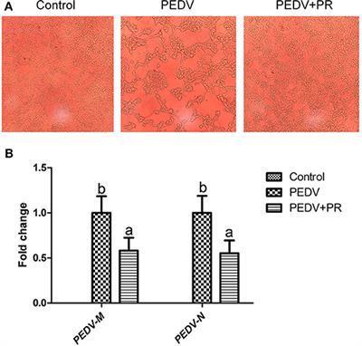 Quantitative Proteomic Analysis Reveals Antiviral and Anti-inflammatory Effects of Puerarin in Piglets Infected With Porcine Epidemic Diarrhea Virus